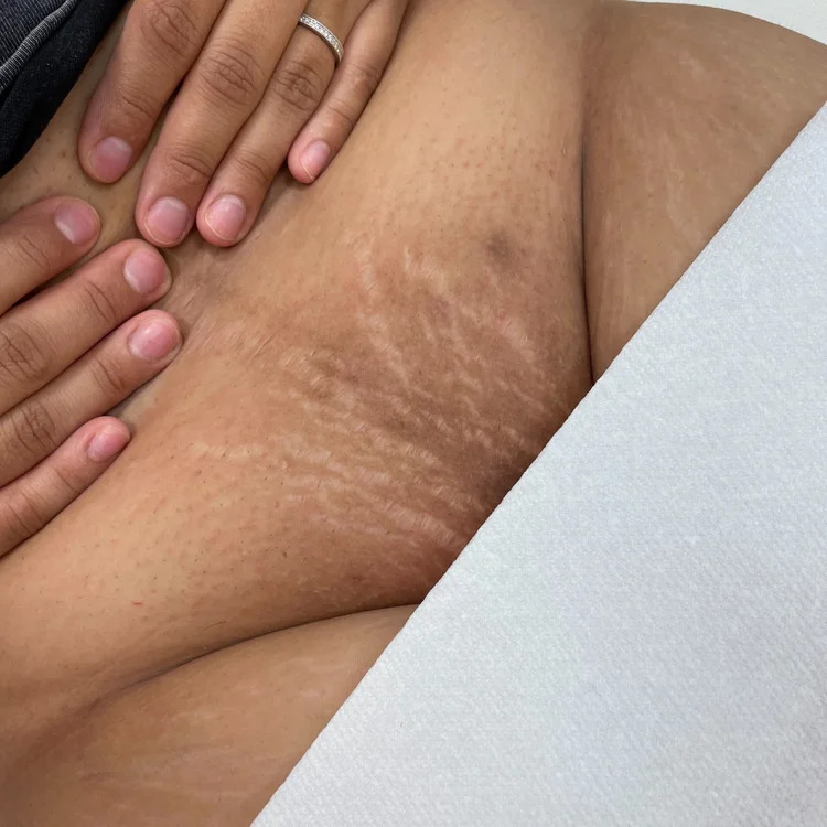 A6F359 72F7 4724 A512 2E3953D0EE79 — waxing service